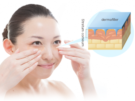 Quanis Dermafiller патчи с растворимыми микроиглами из гиалуроновой кислоты и коллагена