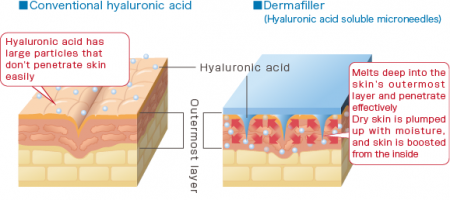 Quanis Dermafiller патчи с растворимыми микроиглами из гиалуроновой кислоты и коллагена