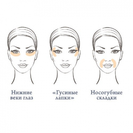 Quanis Dermafiller патчи с растворимыми микроиглами из гиалуроновой кислоты и коллагена